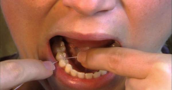 Abolladura rompecabezas pasta 6 pasos para utilizar correctamente hilo dental en las muelas | Centauro
