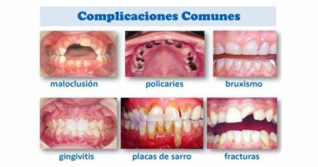 Las Enfermedades Bucales M S Comunes