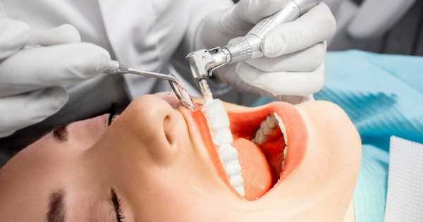 Limpiezas dentales ultrasónicas manuales ¿Cuál es mejor? | Centauro