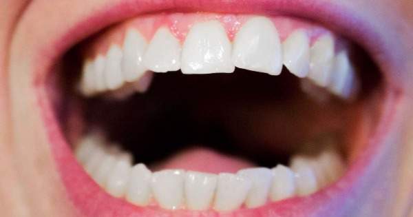 Sabes se los dientes? | Centauro